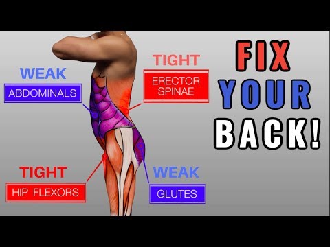 Fix &quot;Anterior Pelvic Tilt&quot; in 10 Minutes/Day (Daily Exercise Routine)