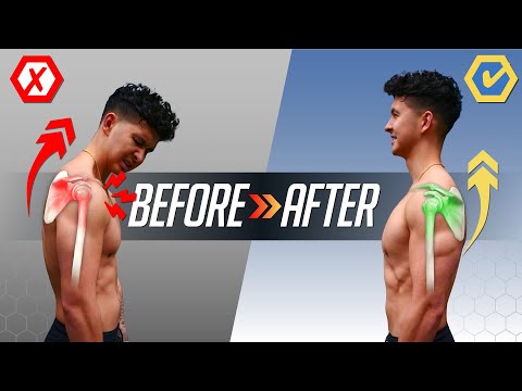 How To Unf*ck Your Shoulders In 10 Minutes (FOR GOOD!)