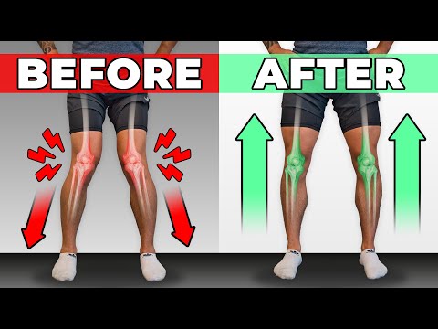 How To Unf*ck Your Knees in 10 Minutes/Day (CORRECTIVE ROUTINE)