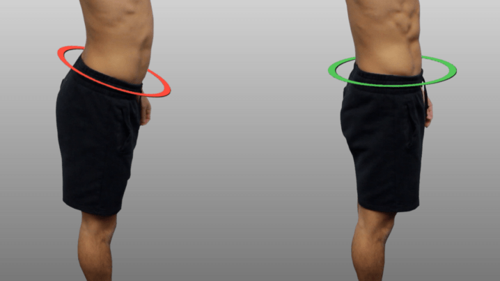 Fix Anterior Pelvic Tilt In 10 Minutes Per Day With This Corrective Routine