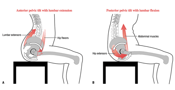 anterior pelvic tilt sitting