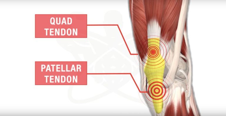 How To Avoid Knee Pain When Squatting: 4 Squat Mistakes You're Making