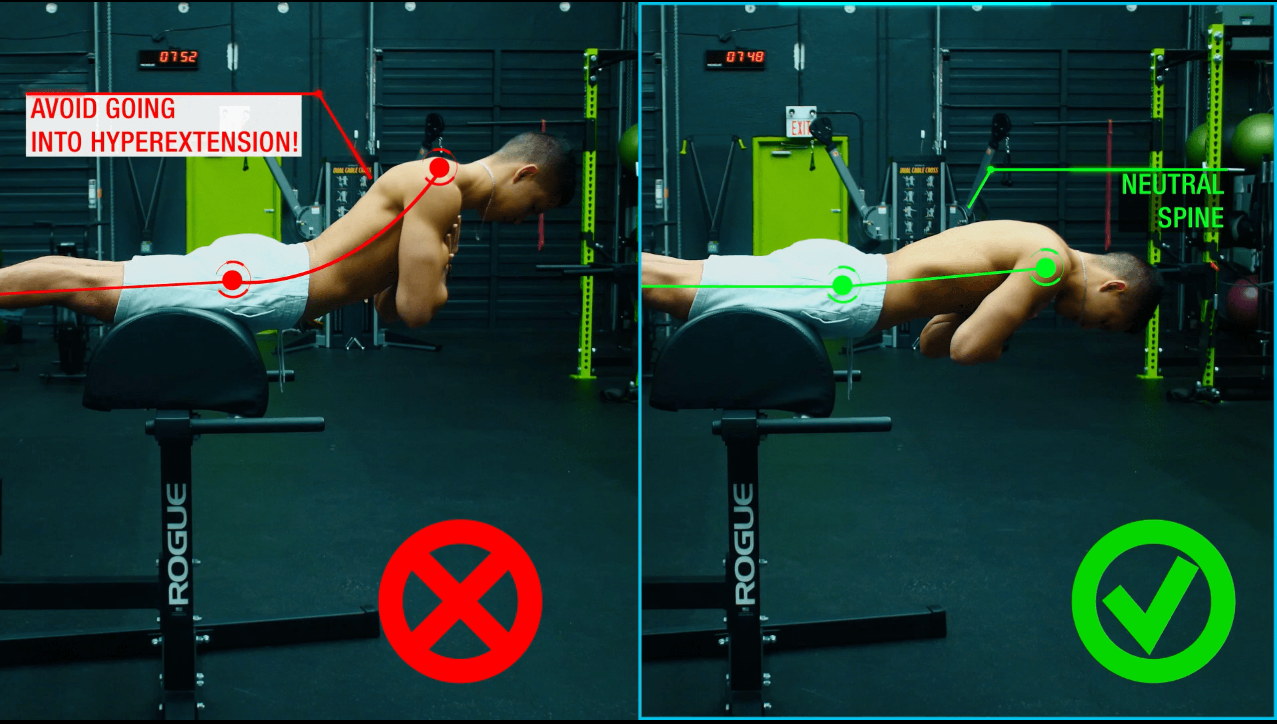 Which Back Extension Is Best For Back Pain?