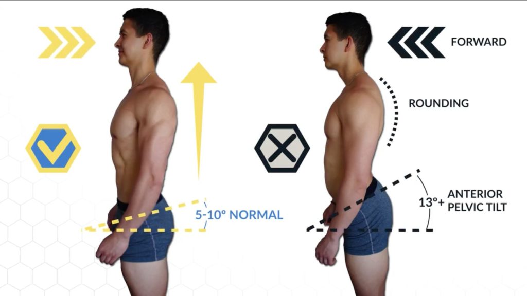 The Perfect Daily Posture Routine To Fix Your Posture From Sitting 