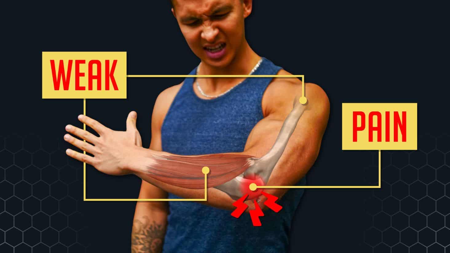What's Up With Your Elbow Pain (And How To Fix It) Built with Science