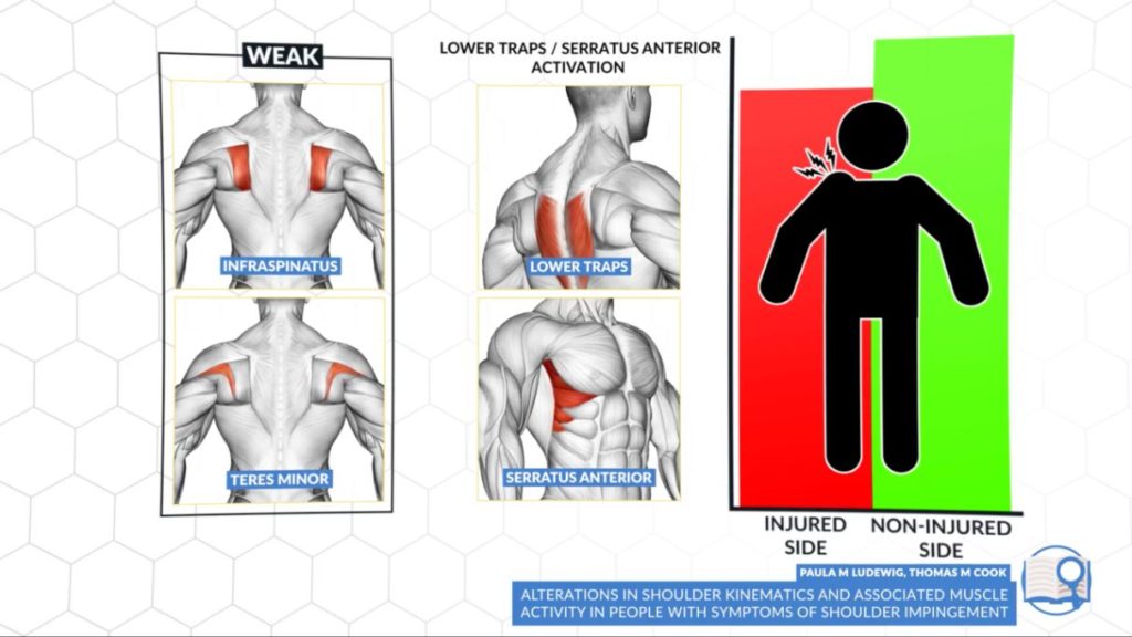 Why Are My Shoulders Crunching? - NYSMI